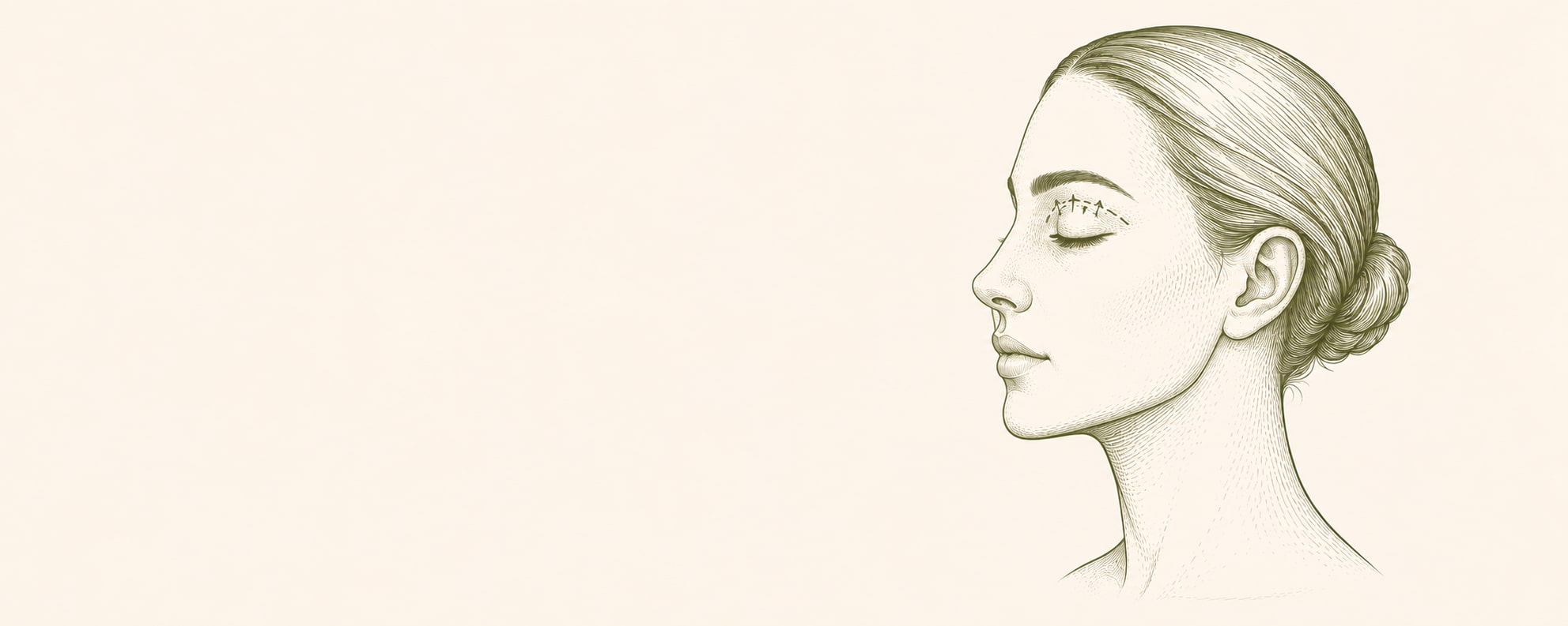 Blepharoplasty